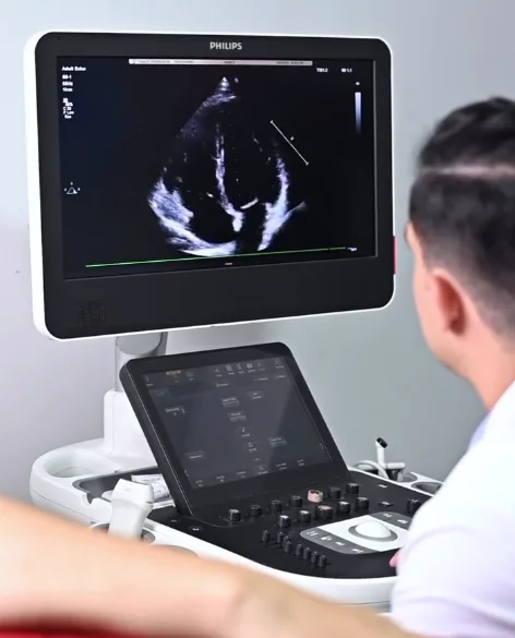 Ecocardiograma transtorácico